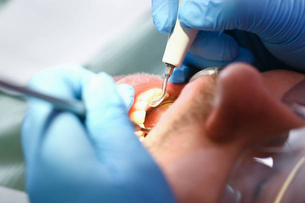 Best Emergency Dental Care for Sports Injuries in Blue Ridge, TX