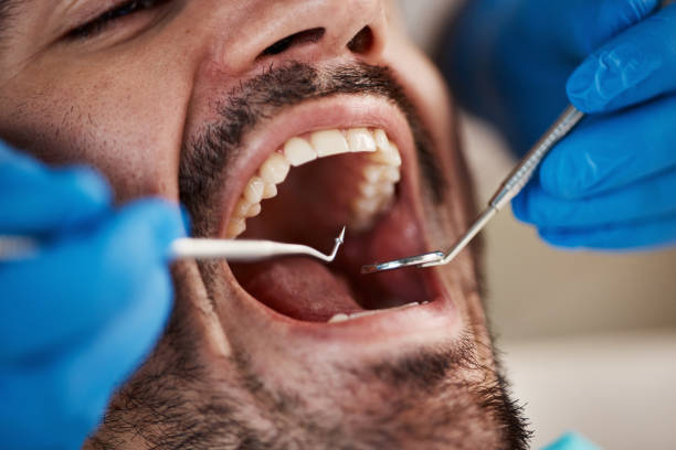 Best 24-Hour Emergency Dental Care in Blue Ridge, TX